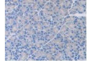 IHC-P analysis of Rat Pancreas Tissue, with DAB staining. (HGF antibody  (AA 306-471))