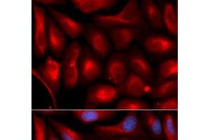Immunofluorescence analysis of U2OS cells using PSMA5 Polyclonal Antibody (PSMA5 antibody)