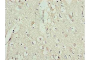 Immunohistochemistry of paraffin-embedded human brain tissue using ABIN7151242 at dilution of 1:100 (TRIM13 antibody  (AA 40-310))