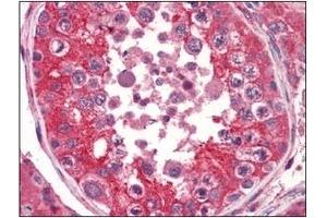 Immunohistochemistry (IHC) image for anti-EPH Receptor A2 (EPHA2) (AA 559-976) antibody (ABIN317513) (EPH Receptor A2 antibody  (AA 559-976))