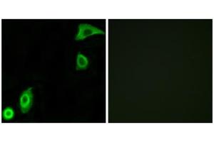 Immunofluorescence analysis of A549 cells, using RPS20 antibody. (RPS20 antibody  (Internal Region))