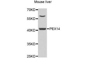 Western blot analysis of extracts of mouse liver, using PEX14 antibody. (PEX14 antibody  (AA 118-377))
