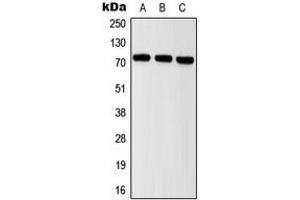 Western blot analysis of ITIH2 expression in MCF7 (A), mouse brain (B), rat brain (C) whole cell lysates.