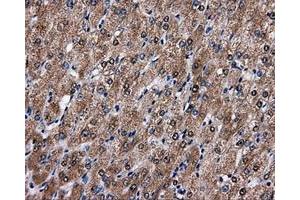 Immunohistochemical staining of paraffin-embedded liver tissue using anti-FAHD2Amouse monoclonal antibody.