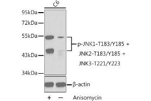 Western blot analysis of extracts from C6 cells untreated or treated with anisomycin using Phospho-JNK1-T183/Y185 + JNK2-T183/Y185 + JNK3-T221/Y223 Antibody (ABIN3020000, ABIN3020001, ABIN3020002 and ABIN7101867). (MAPK8/9/10 antibody  (pThr221, pTyr223))
