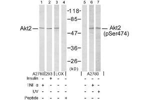 Image no. 2 for anti-V-Akt Murine Thymoma Viral Oncogene Homolog 2 (AKT2) (Ser474) antibody (ABIN197359) (AKT2 antibody  (Ser474))