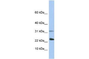 WB Suggested Anti-EXOSC3 Antibody Titration:  0. (EXOSC3 antibody  (C-Term))