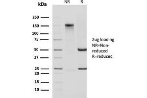 SDS-PAGE Analysis Purified Cytokeratin 14 Mouse Monoclonal Antibody (KRT14/2375). (KRT14 antibody  (AA 351-472))