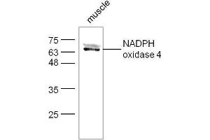 Mouse muscle lysates probed with Rabbit Anti-NADPH oxidase 4 Polyclonal Antibody, Unconjugated  at 1:500 for 90 min at 37˚C.