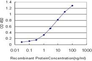 Detection limit for recombinant GST tagged TNNT3 is approximately 0. (TNNT3 antibody  (AA 161-258))