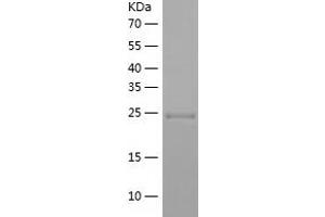 Western Blotting (WB) image for Syntaxin 12 (STX12) (AA 1-248) protein (His tag) (ABIN7287821) (Syntaxin 12 Protein (STX12) (AA 1-248) (His tag))