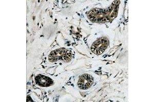 Immunohistochemical analysis of Beta-tubulin staining in human colon formalin fixed paraffin embedded tissue section. (TUBB antibody)
