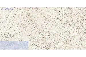 Immunohistochemistry of paraffin-embedded Human uterus tissue using PPARD Monoclonal Antibody at dilution of 1:200. (PPARD antibody)