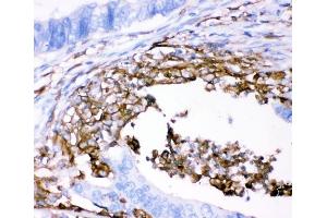 IHC analysis of CD18/ITGB2 using anti-CD18/ITGB2 antibody (ABIN3043260). (Integrin beta 2 antibody  (AA 404-769))