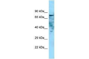 WB Suggested Anti-Golim4 Antibody   Titration: 1. (Golgi Integral Membrane Protein 4 (GOLIM4) (C-Term) antibody)