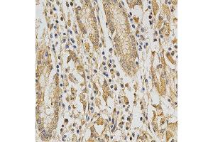 Immunohistochemistry of paraffin-embedded human stomach using DNMT3A antibody at dilution of 1:200 (x400 lens) (DNMT3A antibody)
