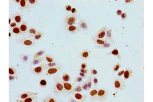 Immunocytochemistry analysis of HepG2 cells using ABIN7139617 at dilution of 1:100 (Histone H1.5 antibody  (pSer17))
