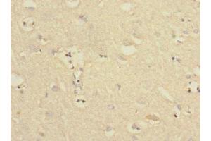 Immunohistochemistry of paraffin-embedded human brain tissue using ABIN7174101 at dilution of 1:100 (PTPN18 antibody  (AA 1-210))