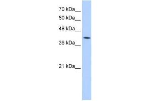 M6PR antibody used at 5 ug/ml to detect target protein. (M6PR antibody)