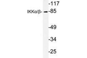 Western blot analysis of IKKα/β antibody in extracts from Jurkat cells. (IKK alpha antibody)