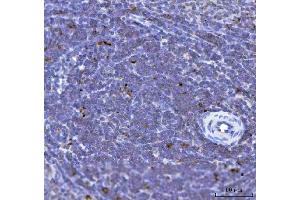 IHC analysis of TFEB using anti-TFEB antibody (ABIN7600648). (TFEB antibody  (AA 214-326))