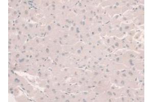 IHC-P analysis of Human Liver Tissue, with DAB staining. (HFE2 antibody  (AA 234-416))