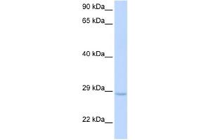 WB Suggested Anti-XRCC2 Antibody Titration: 0. (XRCC2 antibody  (Middle Region))
