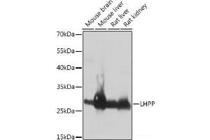 Western blot analysis of extracts of various cell lines using LHPP Polyclonal Antibody at dilution of 1:1000. (LHPP antibody)