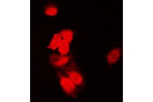 Immunofluorescent analysis of SIAH1/2 staining in HeLa cells. (SIAH1/2 antibody  (Center))