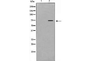 Western blot analysis on Jurkat cell lysate using DCP1A Antibody,The lane on the left is treated with the antigen-specific peptide. (DCP1A antibody  (Internal Region))