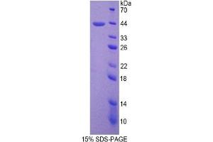 SDS-PAGE of Protein Standard from the Kit (Highly purified E. (SFTPD ELISA Kit)