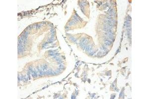 SLPI antibody  (AA 26-132)