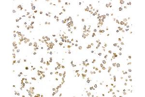 Immunocytochemistry (ICC) image for anti-MHC Class II HLA-DP/DQ/DR (HLA-DP/DQ/DR) antibody (ABIN7449429) (MHC Class II HLA-DP/DQ/DR antibody)