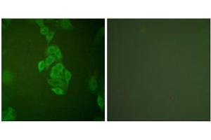Immunofluorescence analysis of A549 cells, using NSE antibody (ABIN5976470). (ENO2/NSE antibody  (C-Term))