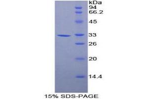 SDS-PAGE analysis of Mouse Annexin A6 Protein.