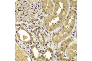 Immunohistochemistry of paraffin-embedded human kidney using SORT1 antibody at dilution of 1:100 (40x lens).