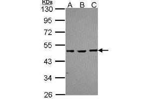 WB Image Sample (30 ug of whole cell lysate) A: A431 , B: JurKat C: Raji 10% SDS PAGE antibody diluted at 1:1000 (MBD2 antibody  (Center))
