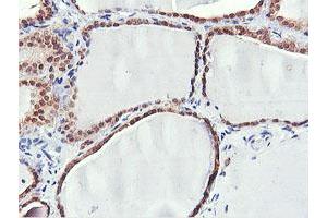 Image no. 2 for anti-Pyridoxamine 5'-Phosphate Oxidase (PNPO) antibody (ABIN1500320)