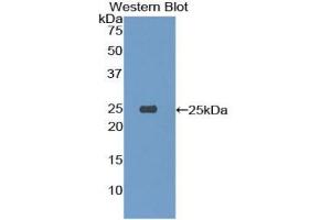 Detection of Recombinant TREM1, Mouse using Polyclonal Antibody to Triggering Receptor Expressed On Myeloid Cells 1 (TREM1) (TREM1 antibody  (AA 21-230))