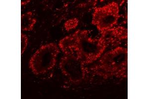 IF analysis of SFPQ using anti-SFPQ antibody (ABIN7603089).