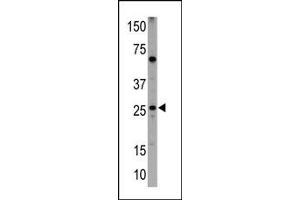 Image no. 1 for anti-BCL2/adenovirus E1B 19kDa Interacting Protein 3 (BNIP3) (BH3 Domain) antibody (ABIN356828) (BNIP3 antibody  (BH3 Domain))