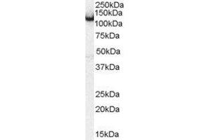 ABIN2561094 (0. (Amphiphysin antibody  (Internal Region))