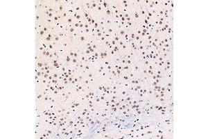 Immunohistochemistry analysis of paraffin-embedded mouse brain using,GTF2F2 (ABIN7074036) at dilution of 1: 3000