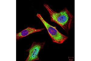Immunofluorescence analysis of Hela cells using ATG5 mouse mAb (green).