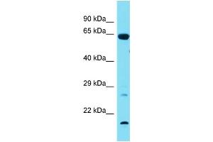 Host:  Rabbit  Target Name:  Tbx18  Sample Type:  Rat Lung lysates  Antibody Dilution:  1. (T-Box 18 antibody  (N-Term))