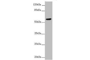 Western blot All lanes: ACVRL1 antibody at 2 μg/mL + MCF-7 whole cell lysate Secondary Goat polyclonal to rabbit IgG at 1/10000 dilution Predicted band size: 57 kDa Observed band size: 57 kDa (ACVRL1 antibody  (AA 22-118))