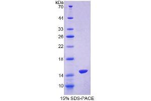 SDS-PAGE (SDS) image for S100 Calcium Binding Protein Z (S100Z) (AA 1-99) protein (His tag) (ABIN6239256)