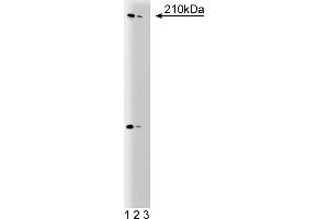 Western Blotting (WB) image for anti-Thyroid Hormone Receptor Interactor 11 (TRIP11) (AA 159-365) antibody (ABIN968639) (Thyroid Hormone Receptor Interactor 11 (TRIP11) (AA 159-365) antibody)