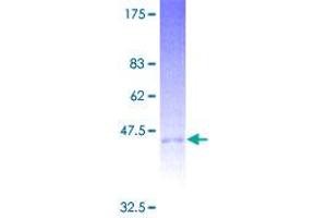 CD94 Protein (AA 1-179) (GST tag)