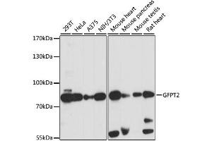 Western blot analysis of extracts of various cell lines, using GFPT2 antibody (ABIN6292819) at 1:1000 dilution.